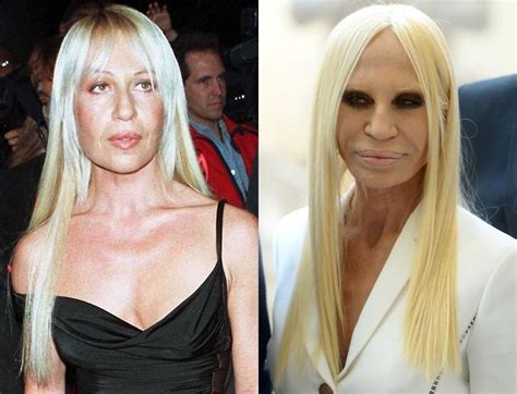 donatella versace estetik faciası|donatella versace hairstyles.